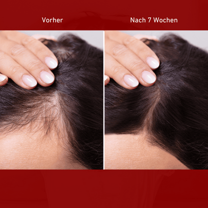 LumiScratch - 3 in 1 Massagebürste